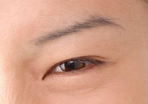 多汗症は治療をして克服することが出来る