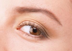 消せない傷跡はレーザー治療で除去しよう