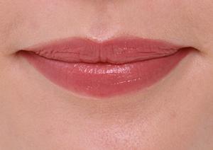 安心してできる婦人科形成とは